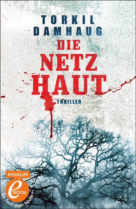 Die Netzhaut
